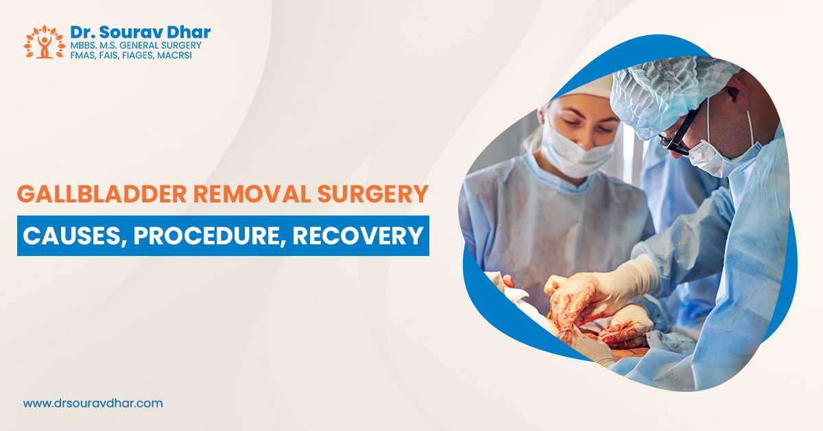 Gallbladder Removal Surgery: Causes, Procedure, Recovery - Dr. Sourav Dhar